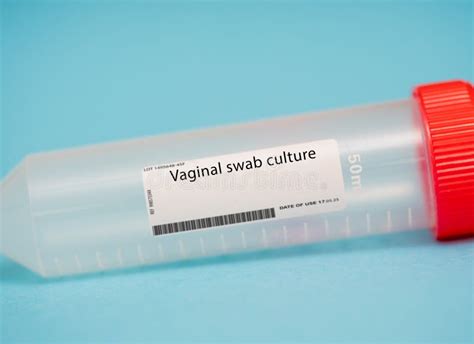 Vaginal Swab Culture Stock Photo Image Of Sample Fungal