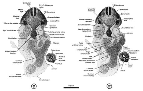 Atlas Of Human Embryos By Rf Gasser Phd Ch5