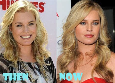 Rebecca Romijn Plastic Surgery Before And After Picture Lovely Surgery