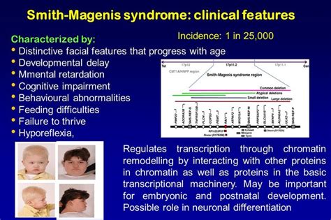 Pin By Nonas Arc On Smith Magenis Syndrome Developmental Delays