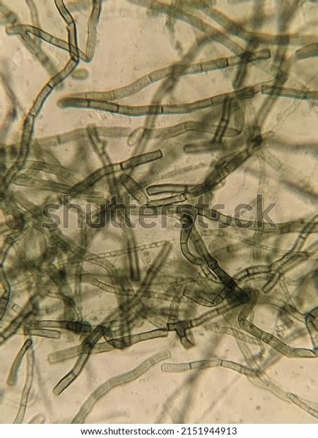 Photo Fungi Hyphae Spores Under Microscope Stock Photo 2151944913