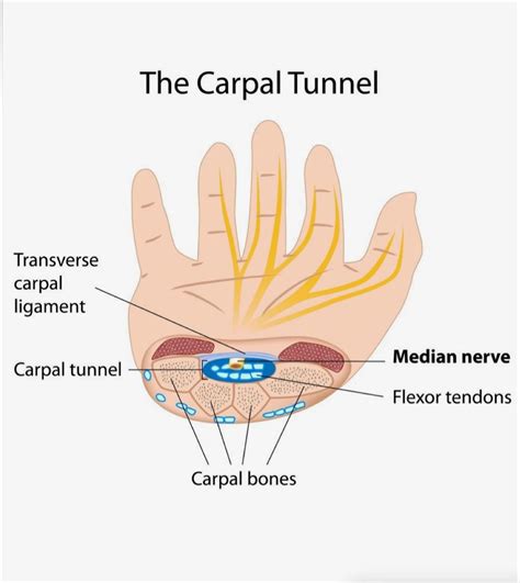 Carpal Tunnel Syndrome Overview
