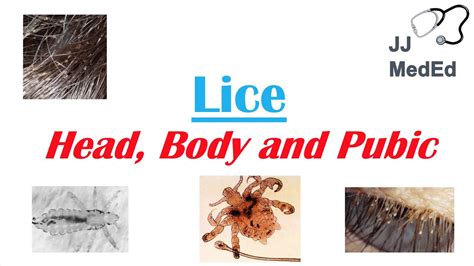 Lice Life Cycle Actual Size Arlyne Lear