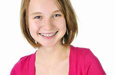 braces girl smiling teenage teen girls smile cute orthodontic woman body boy benefits discover depositphotos sunshine coast dentist dental stand