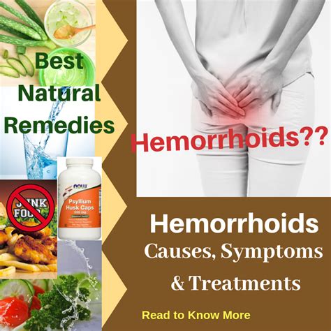 Hemorrhoids Causes Picture Symptoms And Treatments
