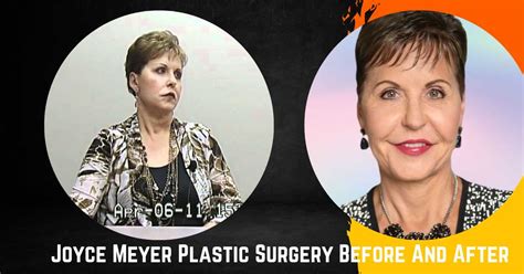 Joyce Meyer Plastic Surgery Transformation Before And After Fame