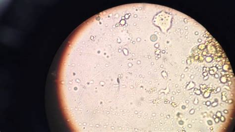 Imagem De Bactérias No Microscópio