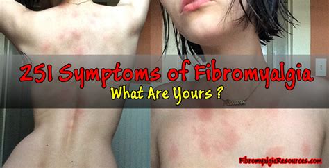 251 symptoms of fibromyalgia hard to believe what are yours fibromyalgia resources