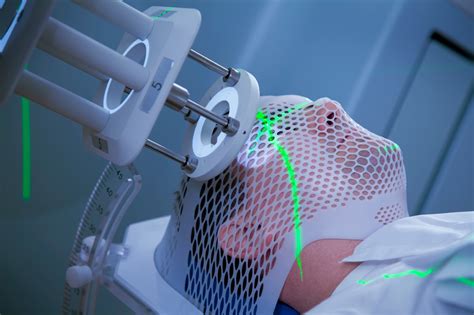 Radiation Therapy An Option For Brain Tumor Surgery Medical Tourism