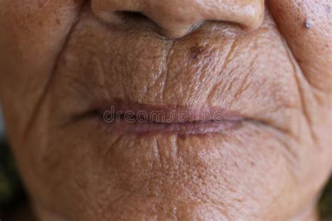 Old Lips With Wrinkled Skin Stock Photo Image Of Lips Texture 25157350