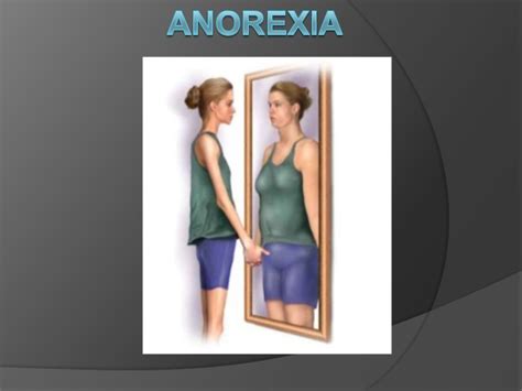 Anorexia Nervosa How To Spot The Signs Counselingrx