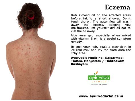 Eczema Is A Disease Of The Skin That Is Found In Both Men And Women It