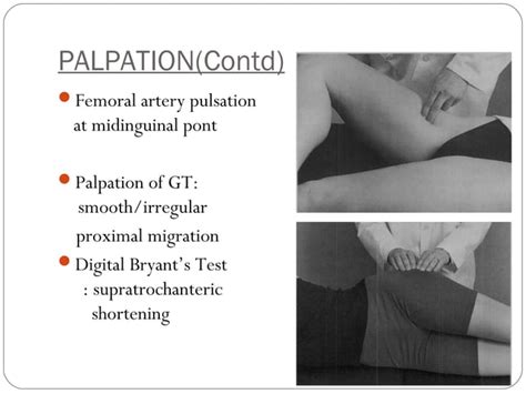Clinical Examination Of Hip Ppt