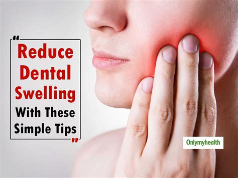 Just Had A Dental Surgery These Tips Can Help Reduce Swelling Post