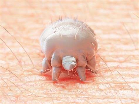 Illustration Of A Scabies Mite Photograph By Sebastian Kaulitzki