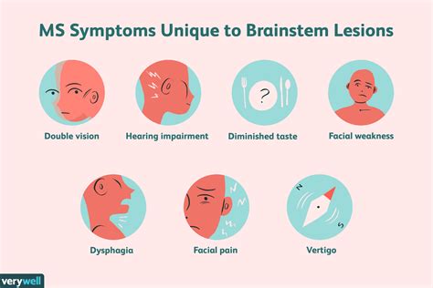 Ms Brainstem Lesions And Their Impact Vrogue Co