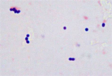 Gram Positive Cocci In Pairs Cloudshareinfo