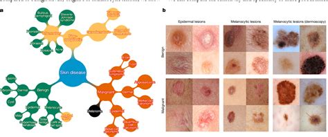 figure 10 from classification of melanoma skin cancer using images