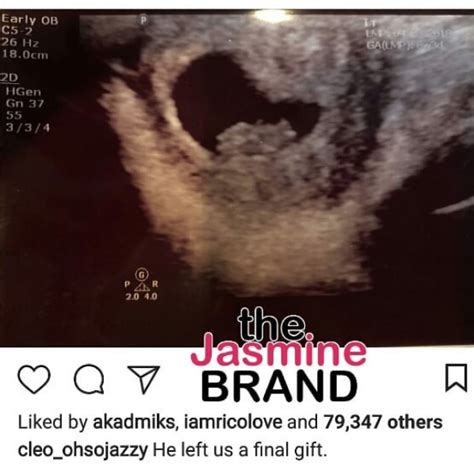 Xxxtentacion S Girlfriend Pregnant Mom Reveals Sonogram Thejasminebrand