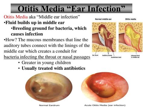 Ppt Sponge Set Up Cornell Notes On Pg 59 Topic 125 Middle Ear