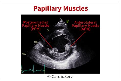 Papillary Muscles Echo Mitral Valve Cardiac Anatomy Cardiac Sonography