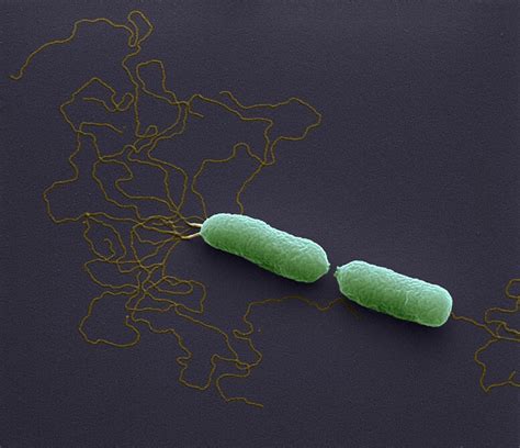 Burkholderi Pseudomallei Bacteria Photograph By Meckes Ottawa Fine