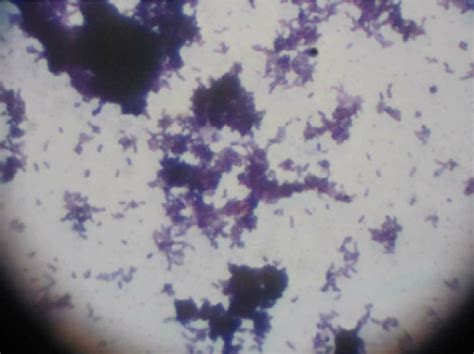 Grams Stain Showing Gram Positive Bacilli Download