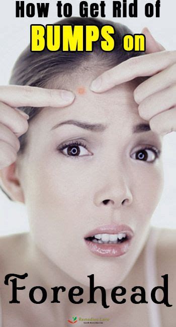 How To Get Rid Of Bumps On Forehead Bumps Forehead