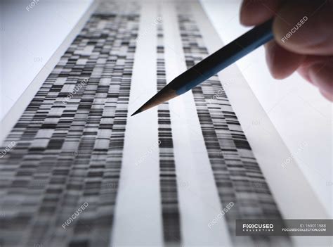 Scientist Viewing Dna Gel Used In Genetics Forensic Pharma Research