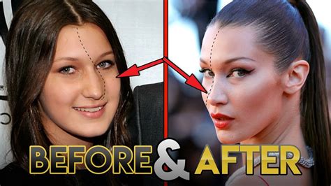 Bella hadid has opened up about wearing lingerie for victoria's secret, and explained how different according to wwd, hadid spoke at the vogue fashion festival in paris, and opened up about hitting. Bella Hadid | Before and After Transformations ( Plastic ...