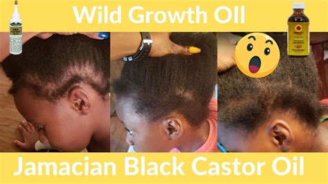 😲wild Growth Hair Oil Before And After Jamaican Castor Oil Hair
