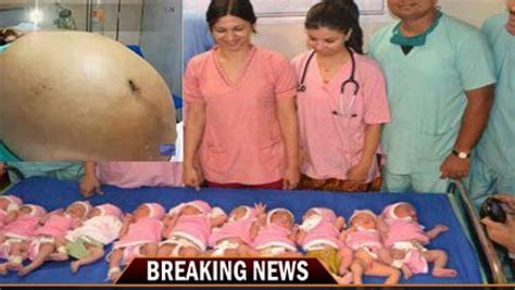 A south african woman entered the guinness world records list after breaking a record for all babies were delivered by caesarean section. Niesamowity poród w Indiach! Kobieta w naturalny sposób ...