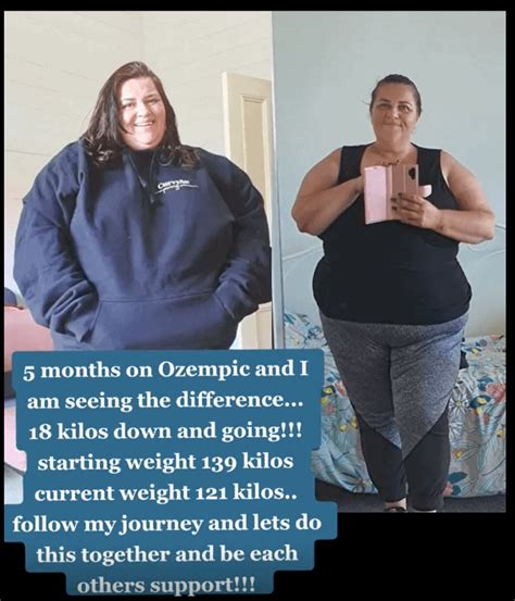 Ozempic Weight Loss Before And After Pictures And Videos Drug Genius