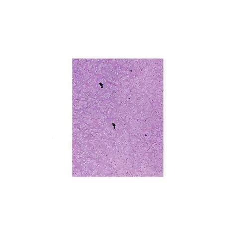 Anatomy Slide Hyaline Cartilage At Rs 500 Piece Prepared Slides In