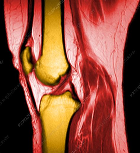 Normal Knee Stock Image F0312773 Science Photo Library