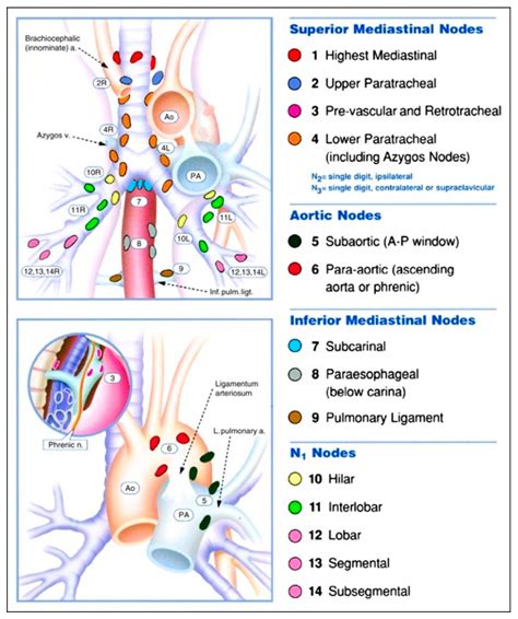 Small cell lung cancer treatment (pdq®): JCM | Free Full-Text | Diagnosing Lung Cancer: The ...