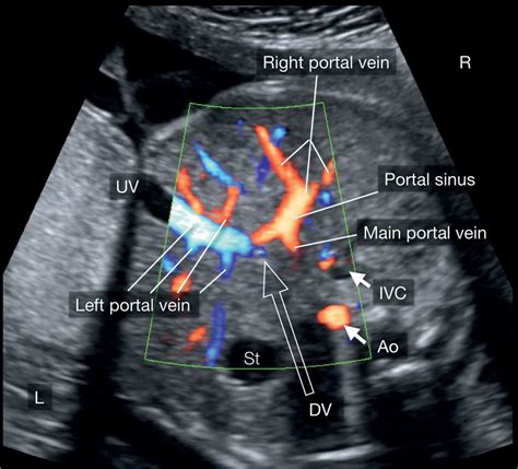 Systematic Evaluation Of The Venous System Obgyn Key