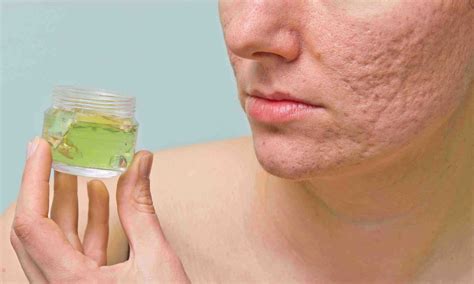 Ayurvedic Skin Care Natural Skin Care Remedies Pure Herbal Ayurved