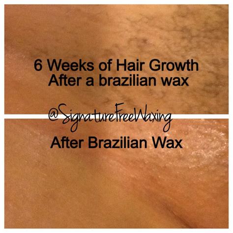 A sticky substance is applied to your hairs, which is then ripped off in order to remove hairs from the roots and leave skin smooth. Top photo: 6 weeks after receiving a Brazilian wax at ...