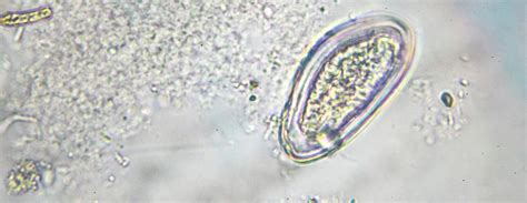 Pinworm Under Microscope