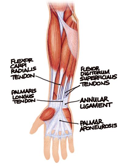 The tear creates swelling and pressure on the tendon which leads to inflammation and the symptoms of forearm tendonitis are the same as any other type of tendonitis (except calcific tendonitis). Human Anatomy for the Artist: The Ventral Forearm: What are those Tendons?