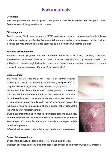 Forunculosis Forunculosis Dermatología Udocz