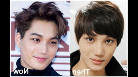 Exos Kai Best Plastic Surgery Before And After Youtube