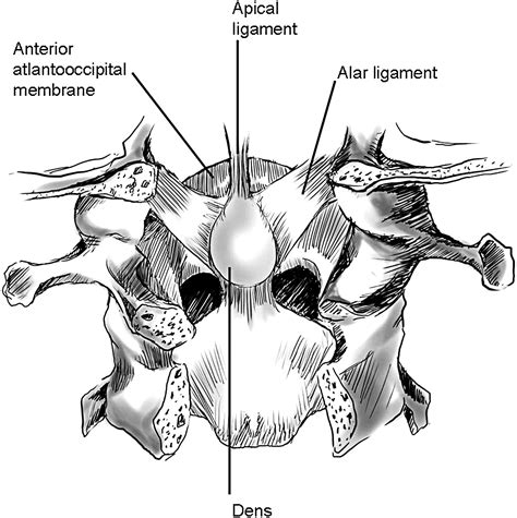 Imaging Of Craniovertebral Junction Neuroimaging Clinics