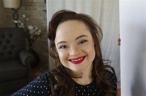 Model With Downs Syndrome Blasts Lack Of Diversity But Promises To