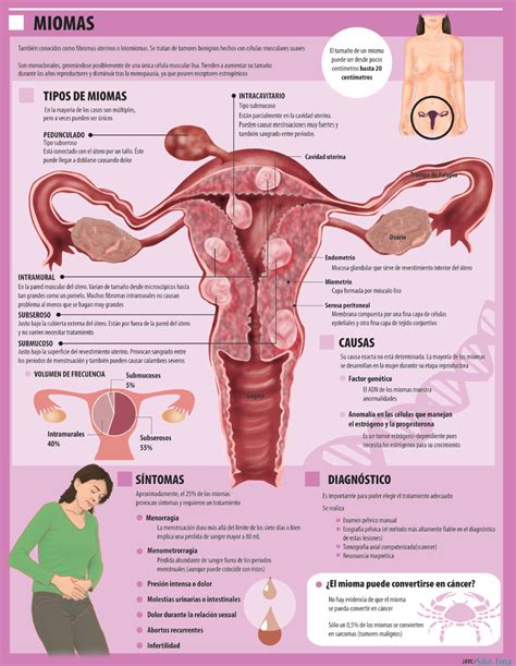 Cancer En La Matriz Sintomas Y Causas Cancerwalls