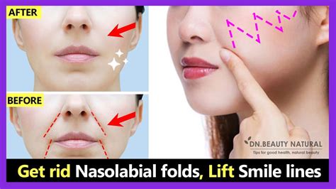 Get Rid Smile Wrinkles Laugh Lines Nasolabial Folds Lift Smile Lines Face Yoga And Massage