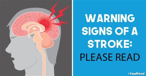 Watch Out For These 12 Signs Of Stroke In 2020 Stroke Association 12