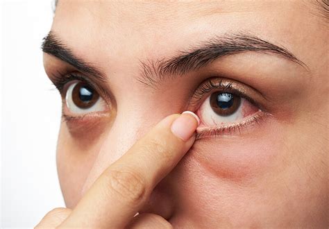 Dry Eyes Can Affect Your Quality of Life - Looking Glass Optical