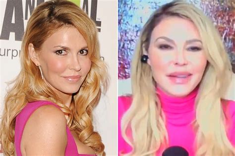 Did Brandi Glanville Have A Plastic Surgery What Happened To Her Face Business Guide Africa
